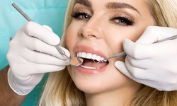 The Perks of Choosing Porcelain Veneers for Your Dental Transformation
