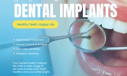What is dental implants placement ? Are dental implants safe ?