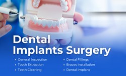 What is Dental Implants Surgery ?