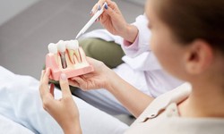 What is Dental Implants Therapy ?