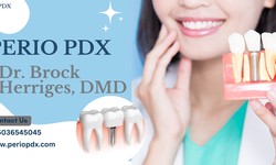 Why Choose Perio PDX For Dental Implants Placement ?