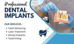 What is Dental Implant Placement Procedure ?