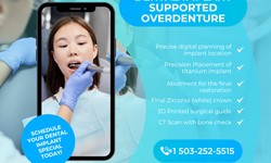 What Is Implant Supported Overdenture?