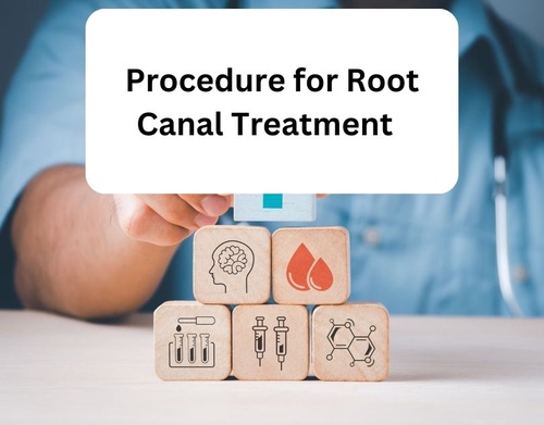 Procedure for Root Canal Treatment
