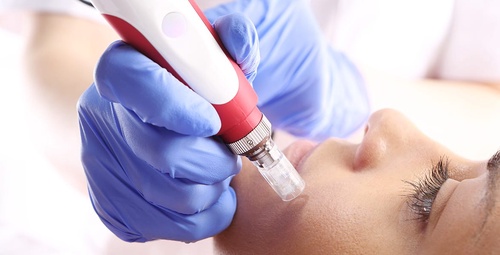 What Is the PRP Treatment and Why Celebrities Are Going Nuts Over It