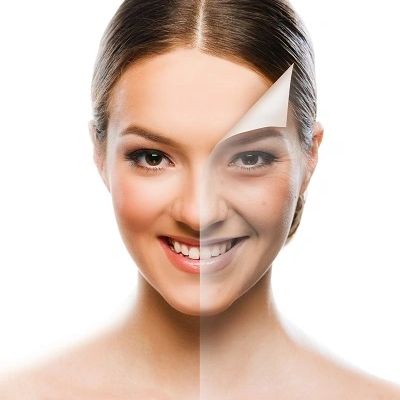 Benefits Of Derma Peel in Mississauga