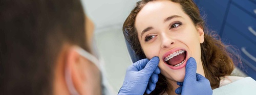 Choosing the Right Type of Dental Braces for Your Needs