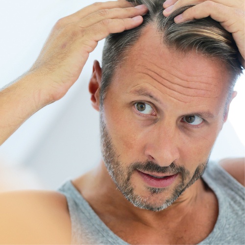 Budget-Friendly Beauty: The Ultimate Guide to Finding the Best Hair Transplant in Turkey for an Amazing Price