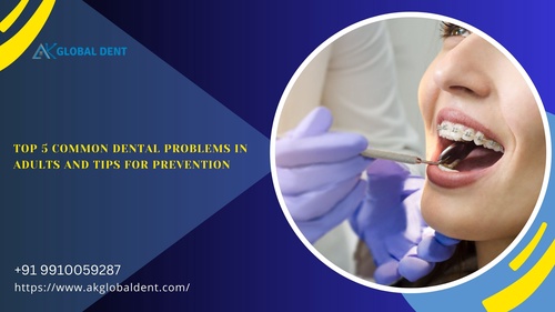Top 5 Common Dental Problems in Adults and Tips for Prevention