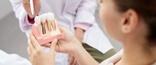 Importance Of Dental Care After 30