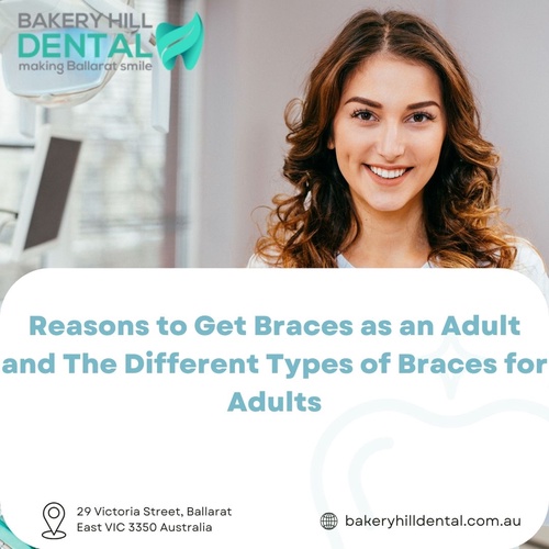 Reasons to Get Braces as an Adult and The Different Types of Braces for Adults