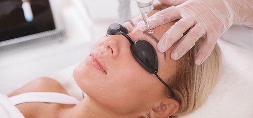 Flawless Futures: Eyebrow Laser Tattoo Removal and Self-Esteem