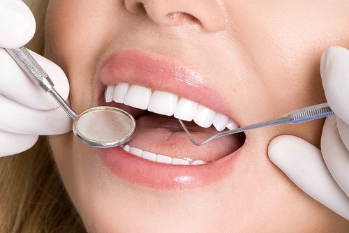 Dubai's Painless Dental Veneers: Exploring Comfortable Solutions