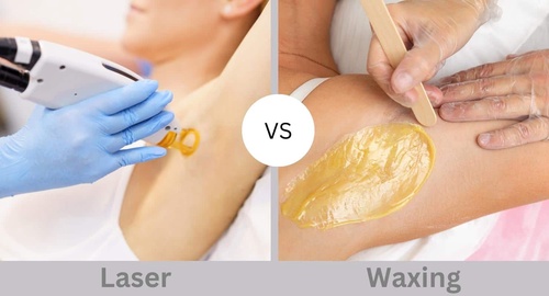 Smooth Sailing: Laser Hair Removal or Waxing Whims?