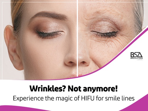 Unlocking the Power of HIFU Treatment: A Revolutionary Approach to Skin Rejuvenation