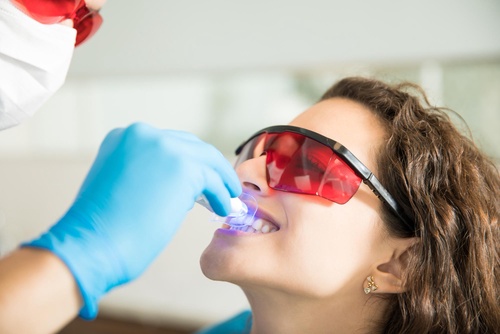Illuminating the Process: Demystifying Teeth Whitening