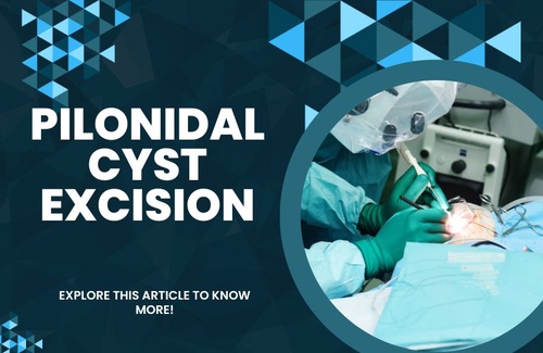 What You Need to Know About Pilonidal Cyst Surgery?