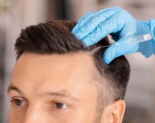 Who Is a Candidate for Female Hair Transplant?