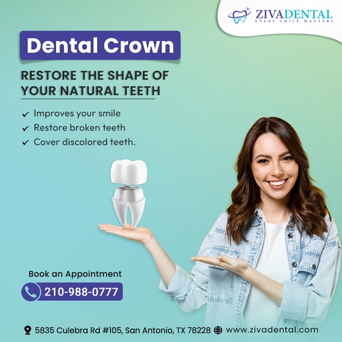 Importance of Dental Crown In Treating Tooth Decay