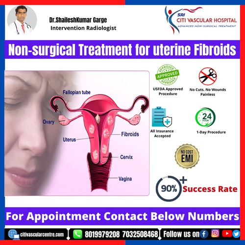Best treatment for uterine fibroids in Hyderabad
