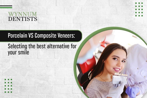 Porcelain vs Composite Veneers: Selecting the Best Option for Your Smile
