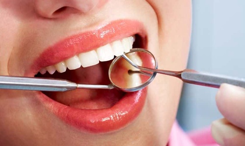 Dental Bonding: A Cost-Effective Solution for Smile Enhancement
