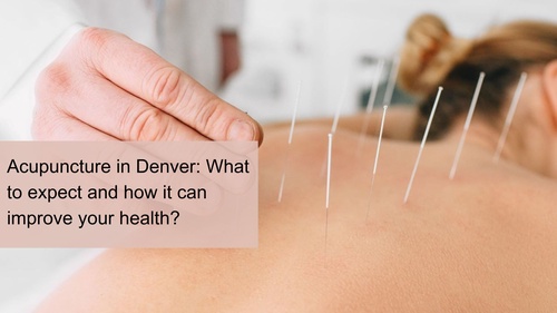 Acupuncture in Denver: What to expect and how it can improve your health?