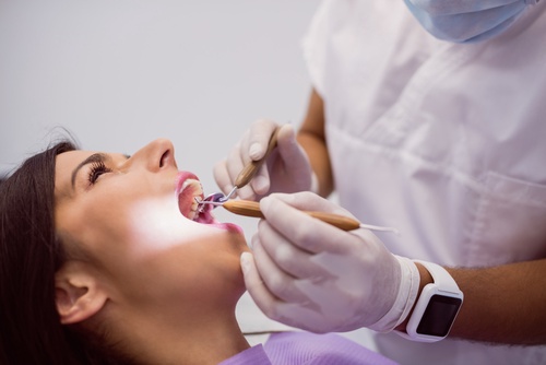 Understanding the Procedure and Treatment of Root Canal