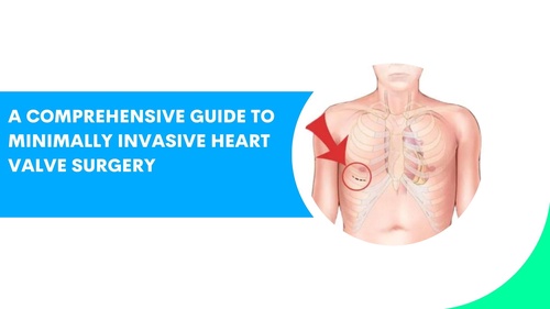 A Comprehensive Guide to Minimally Invasive Heart Valve Surgery
